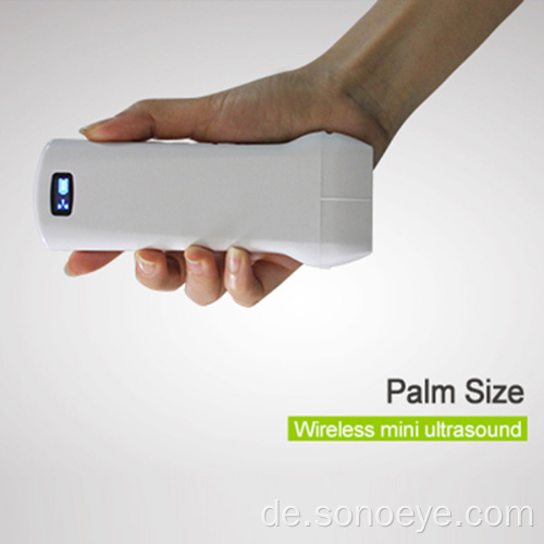 Linearer Seriendontyp Wireless Mini Ultraschallscanner